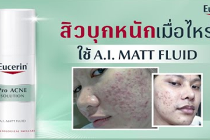 สิวบุกเมื่อไหร่ ใช้ Eucerin A.I. MATT FLUID