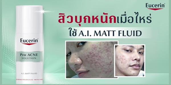 สิวบุกเมื่อไหร่ ใช้ Eucerin A.I. MATT FLUID